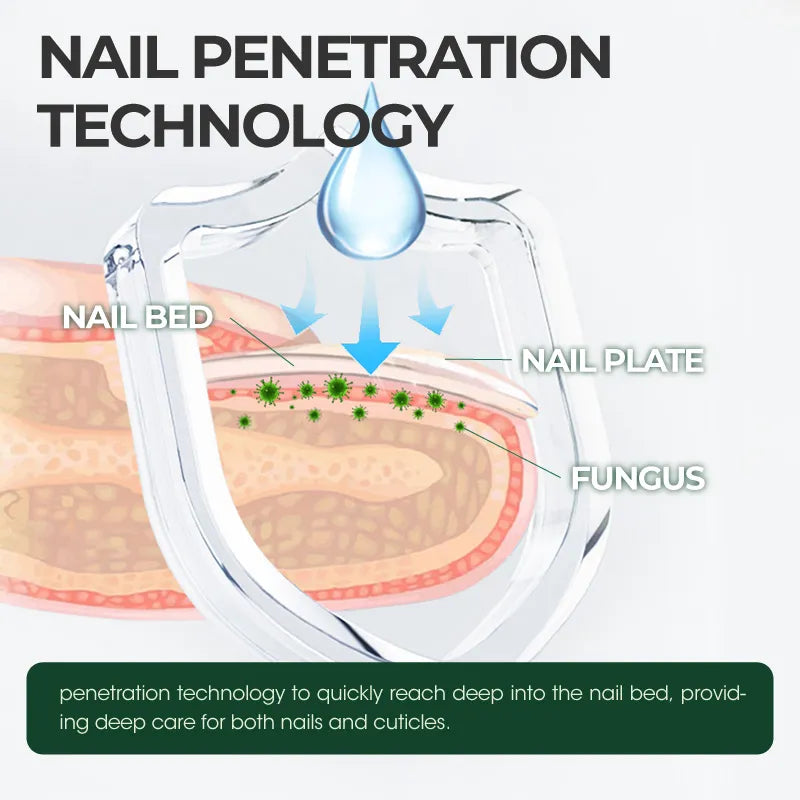 ForestGuard Nail Rescue Serum- 50 % OFF