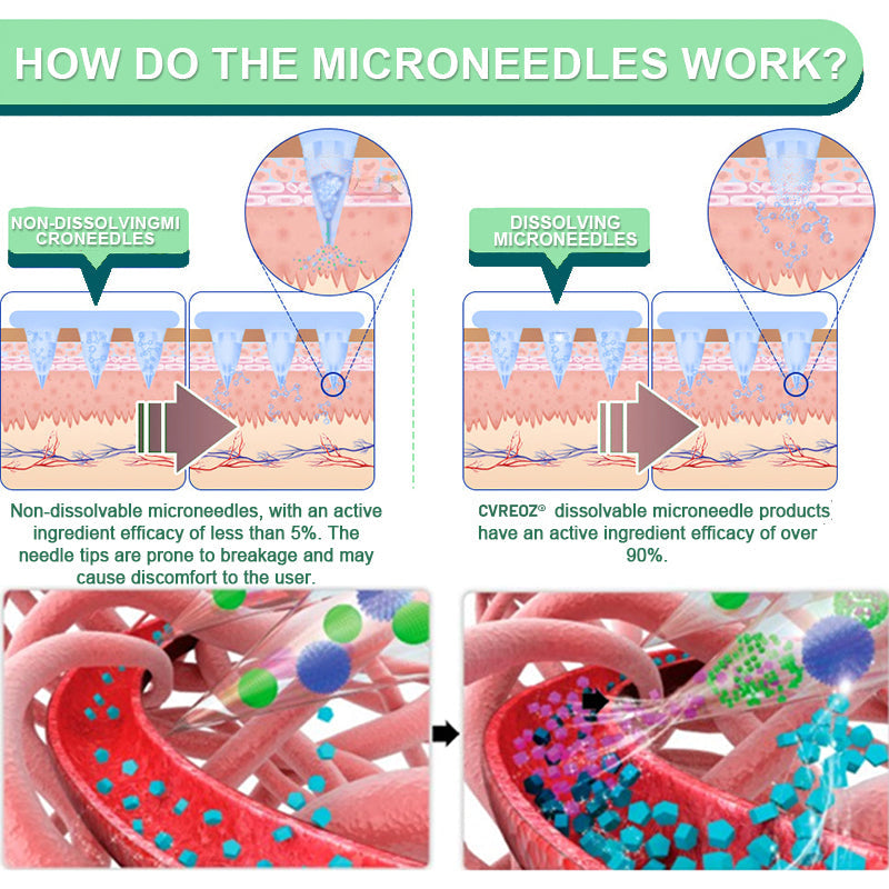 The Tirzepatide Nano-Patch - Lose 20lbs FAST + 50% OFF