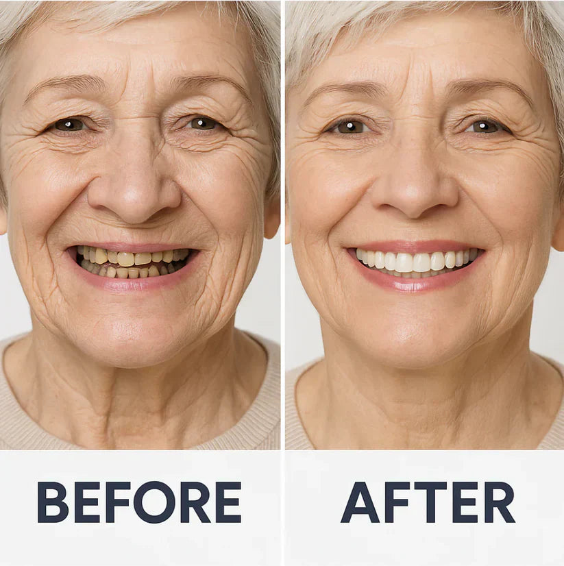SmileFit Functional Denture Set- 50 % OFF