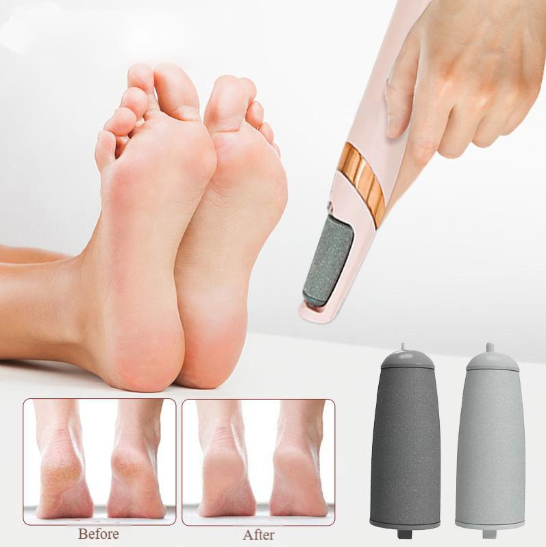 SmoothStep Rechargeable Callus Remover- 50 % OFF