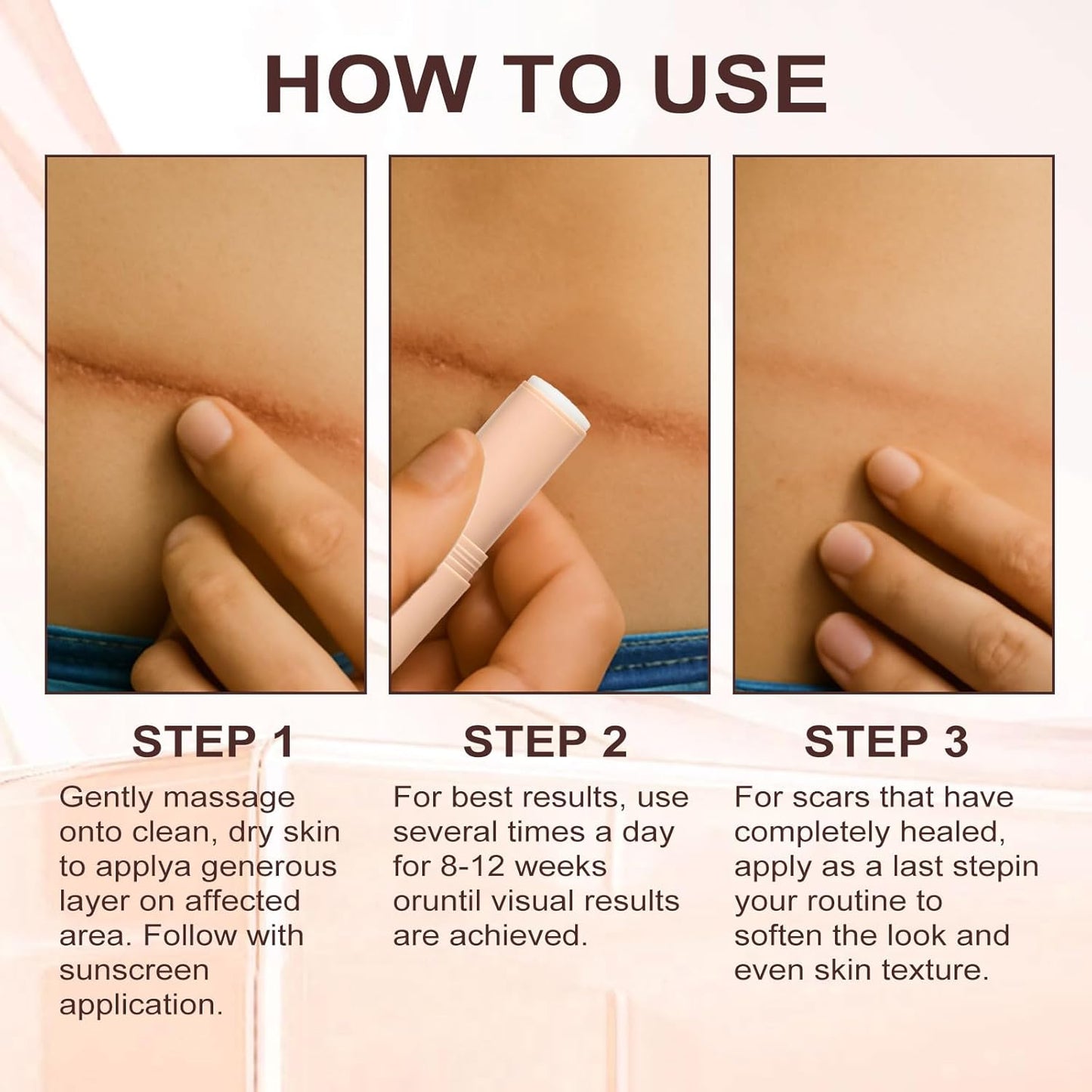 The AuraSmooth Scar Stick - 60% Medical-Grade Silicone, Centella Asiatica, and 100% Satisfaction Guarantee +50% OFF