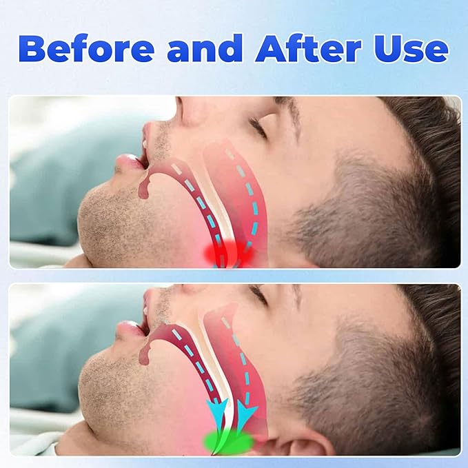 SilenceRest Sleep Guard- 50 % OFF