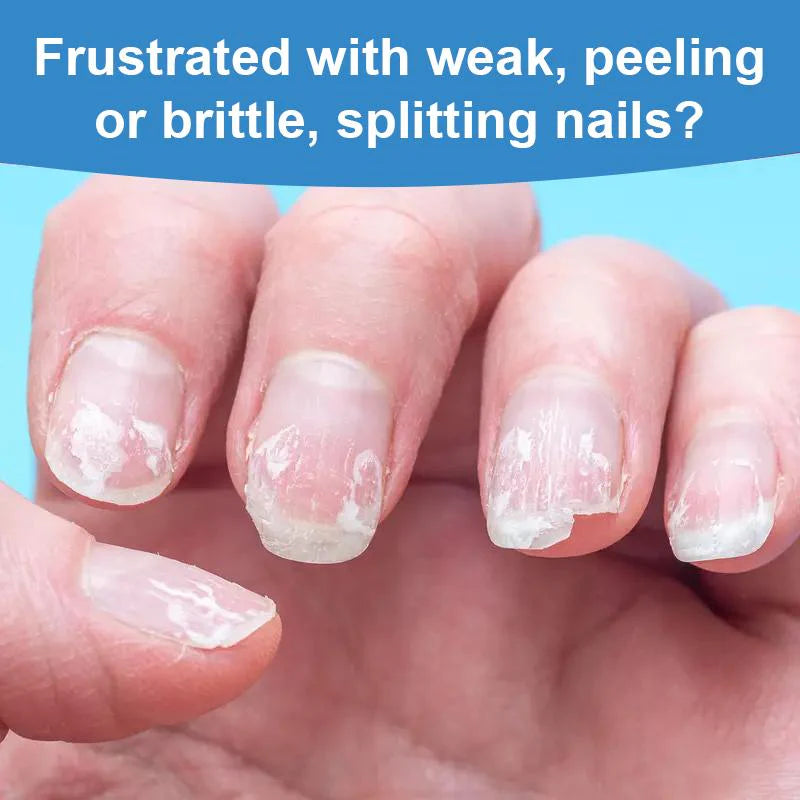 The 3-Day Nail Rescue - Keratin Power, Salon Shine, and Scratch-Proof + 50% OFF