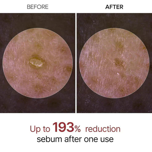GlowRice™ Gentle Exfoliator Ampoule- 50 % OFF