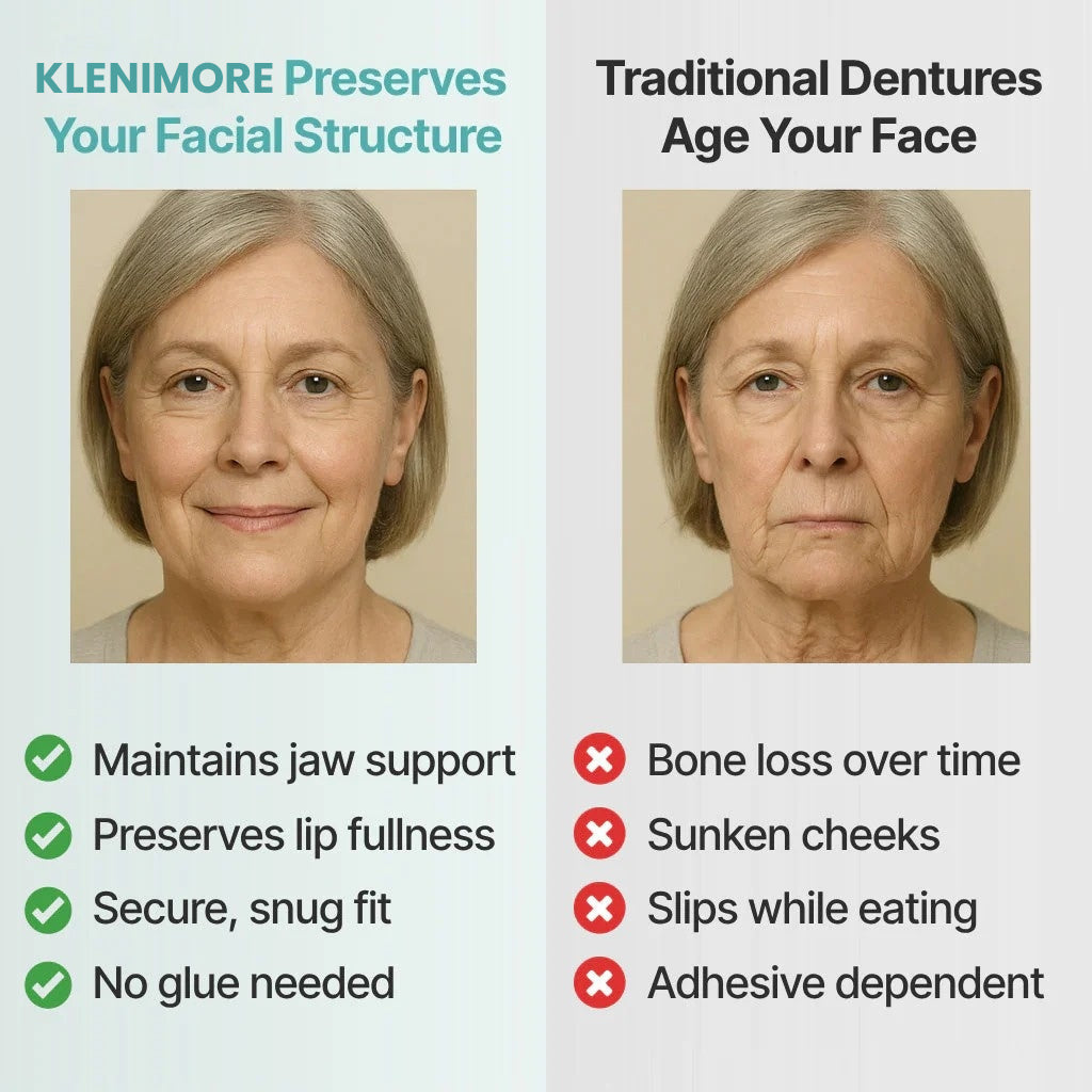 KLENIMORE™ - A Perfect Natural Smile Instantly- UP TO 50% OFF