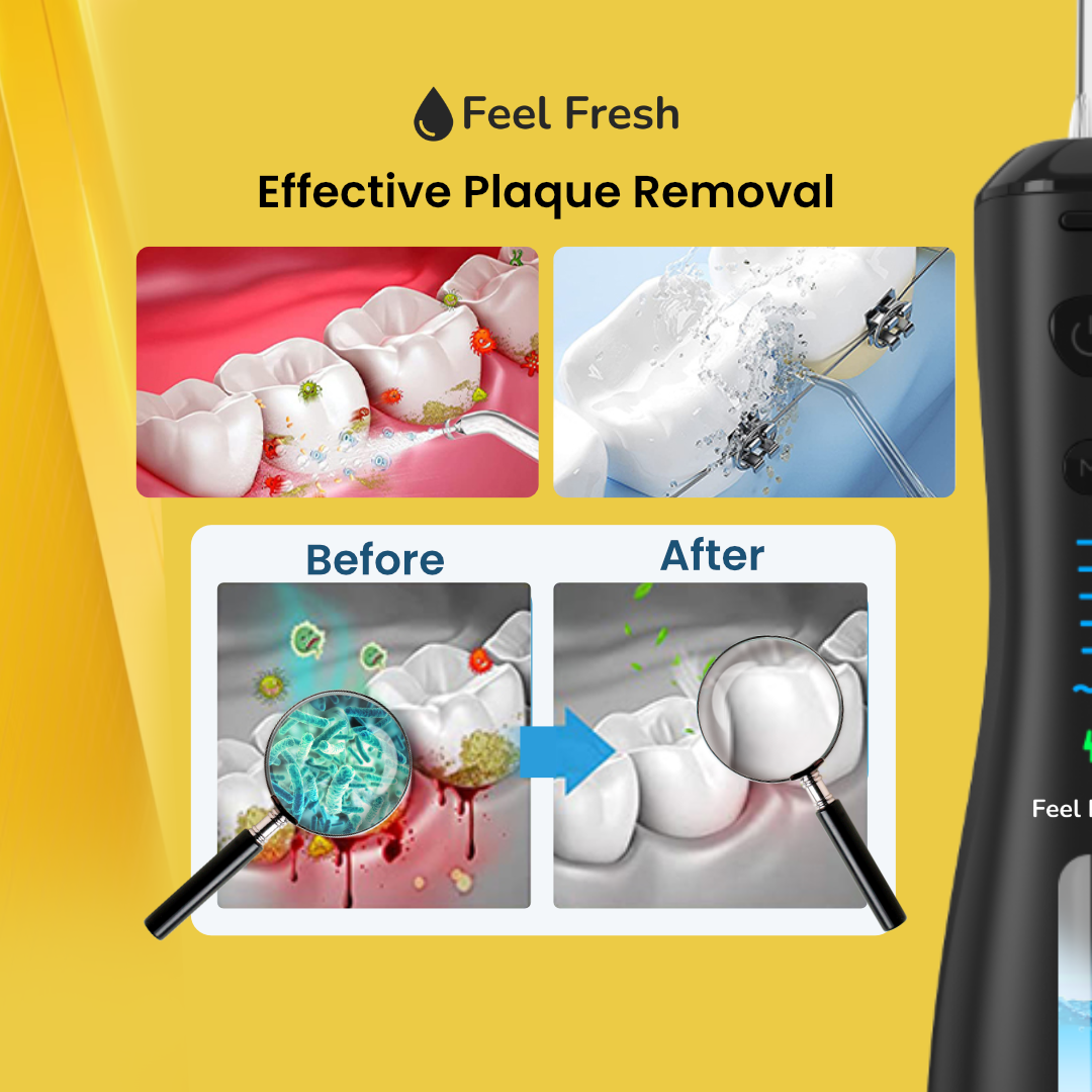 FreshFlow™ Water Flosser- 50 % OFF