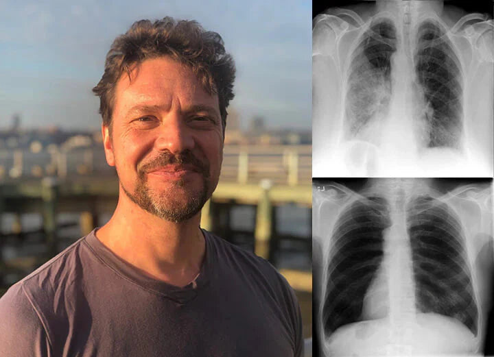 The AuraFlow Mullein Lung Spray - 3x Concentrated Mullein, MHRA-Certified, and 8-Week Respiratory Recovery + 50% OFF