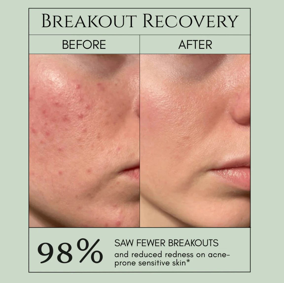 PorePure Bubble Mask - Clear Skin in 7 Days + 50% OFF