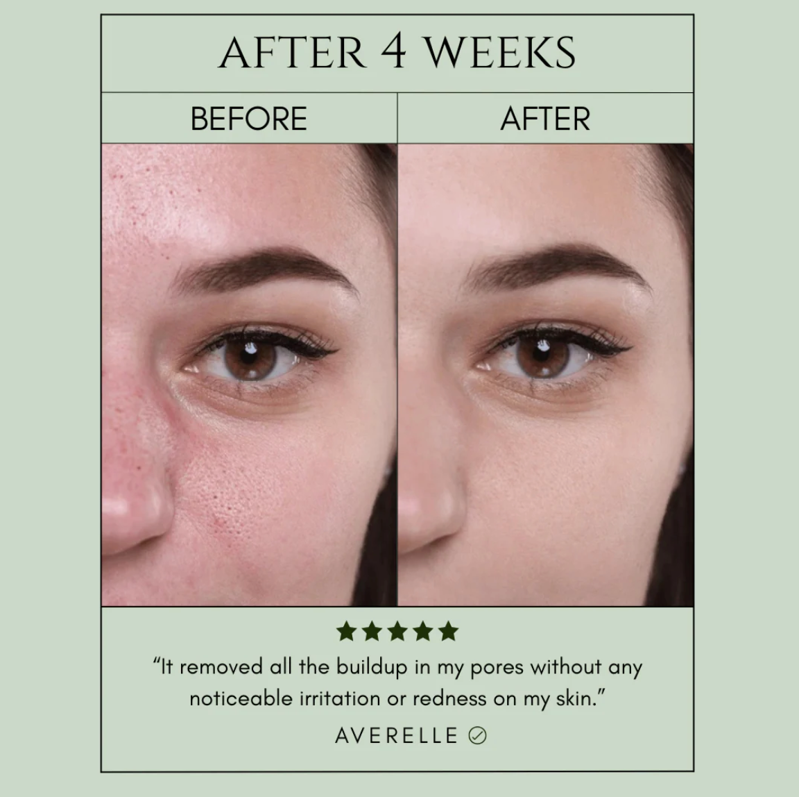 PorePure Bubble Mask - Clear Skin in 7 Days + 50% OFF