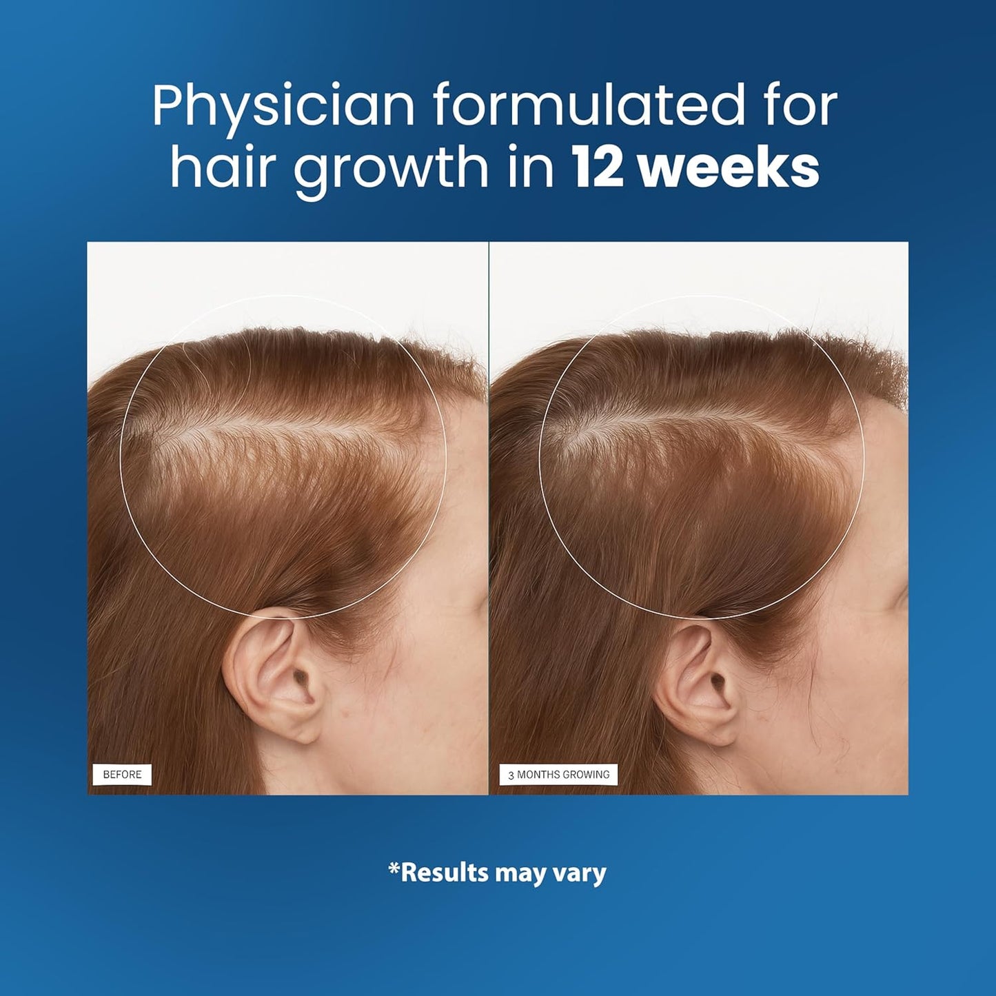 The Triple-Action Hair Serum - Thicker Strands, No Mess + 50% OFF