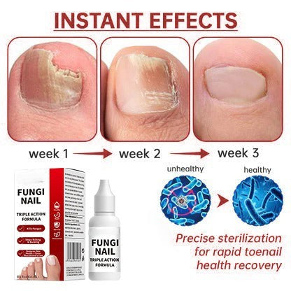 NailRenew™ Triple-Action Nail Repair - Clear Nails, Renewed Confidence + 50% OFF