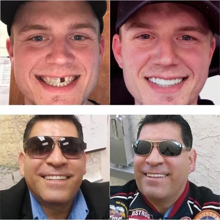 PhotoReady Smile Veneers - A Perfect Smile in Minutes +50% OFF