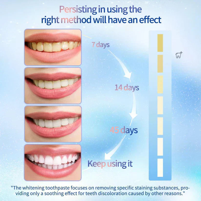 LumiSmile Niacinamide Whitening Toothpaste- 50 % OFF