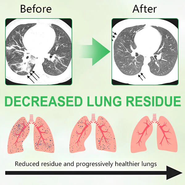 The AuraFlow Mullein Lung Spray - 3x Concentrated Mullein, MHRA-Certified, and 8-Week Respiratory Recovery + 50% OFF