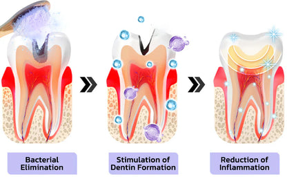 DENTASHIELD – Restore Your Natural Dental Bio-Barrier + 50% OFF FLASH SALE