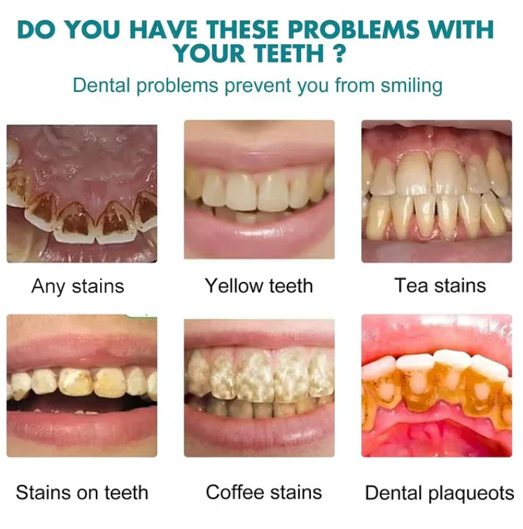 DentalGlow - Instant Radiance For Brighter, Smoother Enamel + 50% OFF