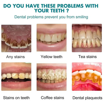 DentalGlow - Instant Radiance For Brighter, Smoother Enamel + 50% OFF