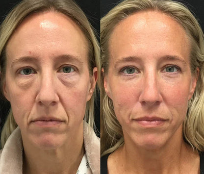 The Renewing 10s Instant-Lift Serum – Fast-Acting Lift for a Noticeably Younger Look in Seconds + 50% OFF