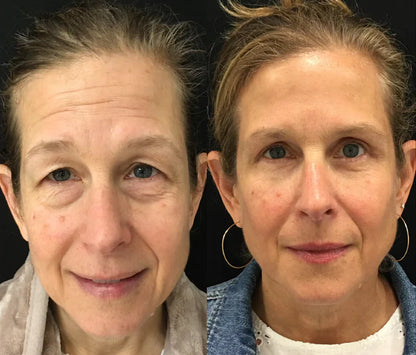 The Renewing 10s Instant-Lift Serum – Fast-Acting Lift for a Noticeably Younger Look in Seconds + 50% OFF