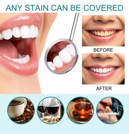 DentalGlow - Instant Radiance For Brighter, Smoother Enamel + 50% OFF