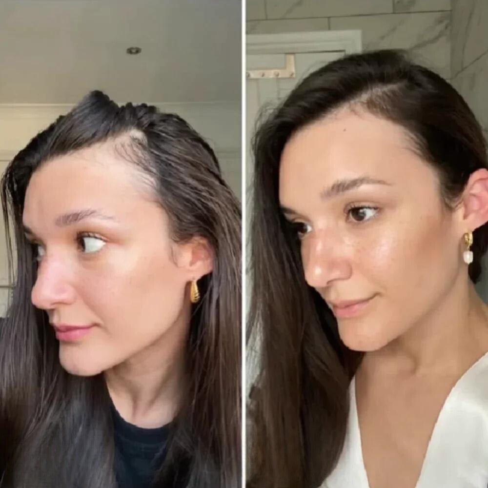 The AuraGrowth Minopia Oil - 11 Oil Concentrated Growth Blend, 100 Vegan, and Thicker Hair in 45 Days + 50% OFF