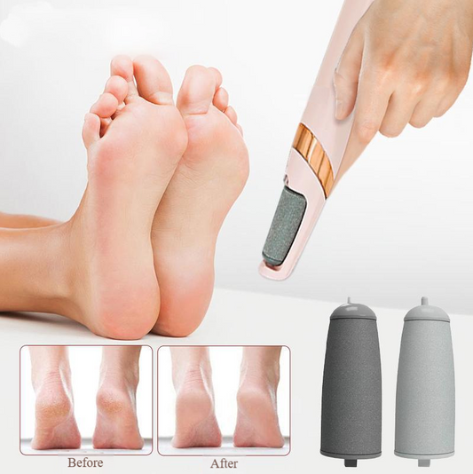 SmoothStep Rechargeable Callus Remover- 50 % OFF