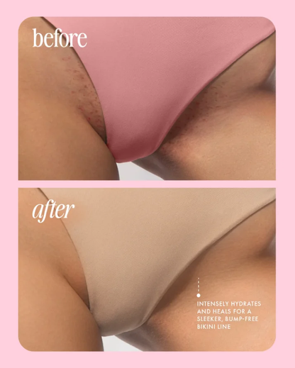 The GlowUp Healing Oil - Glass Skin, Post-Shave + 50% OFF