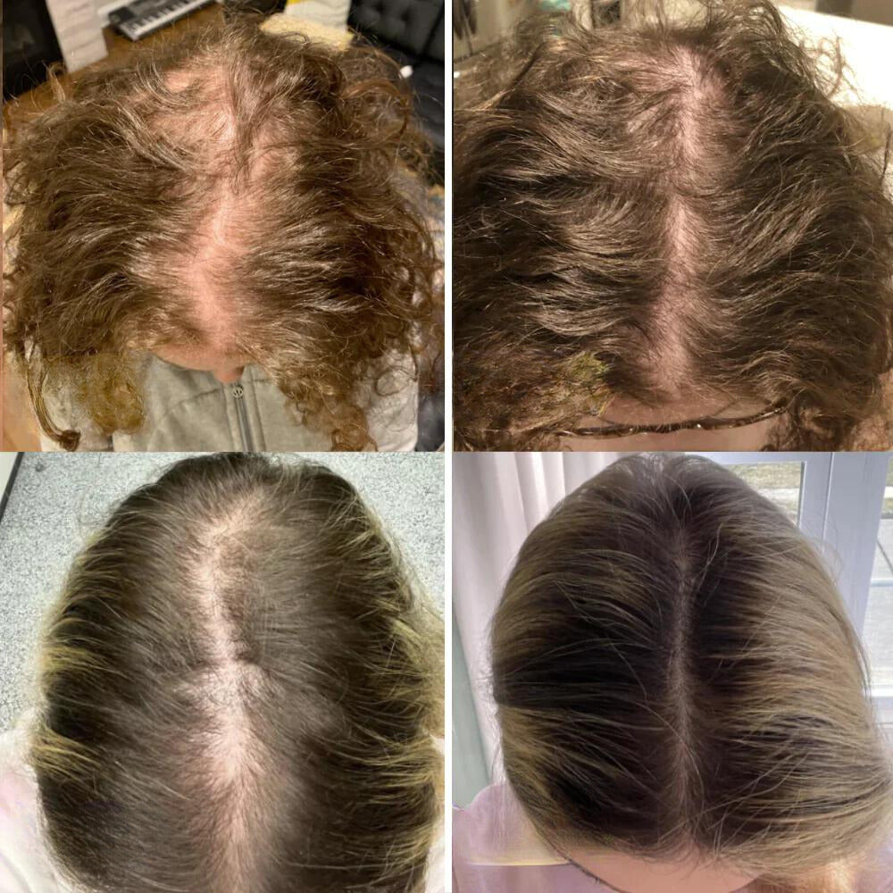 The AuraGrowth Minopia Oil - 11 Oil Concentrated Growth Blend, 100 Vegan, and Thicker Hair in 45 Days + 50% OFF