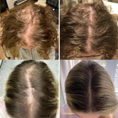 The AuraGrowth Minopia Oil - 11 Oil Concentrated Growth Blend, 100 Vegan, and Thicker Hair in 45 Days + 50% OFF