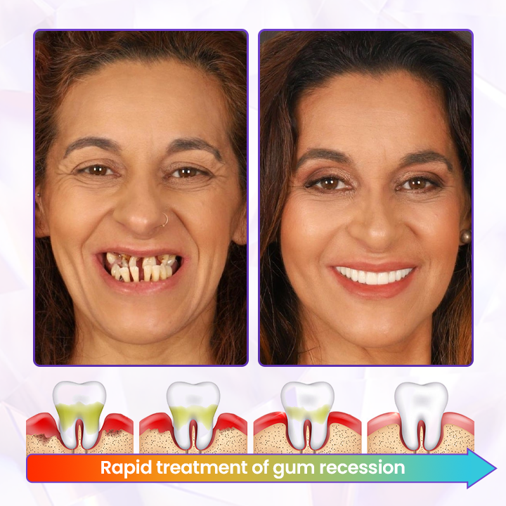 BeeRenew - Restore Gum Vitality Instantly + 50% OFF
