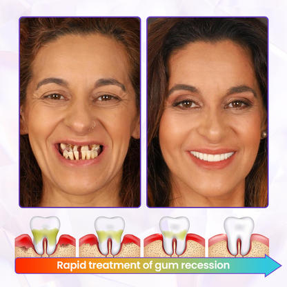 BeeRenew - Restore Gum Vitality Instantly + 50% OFF