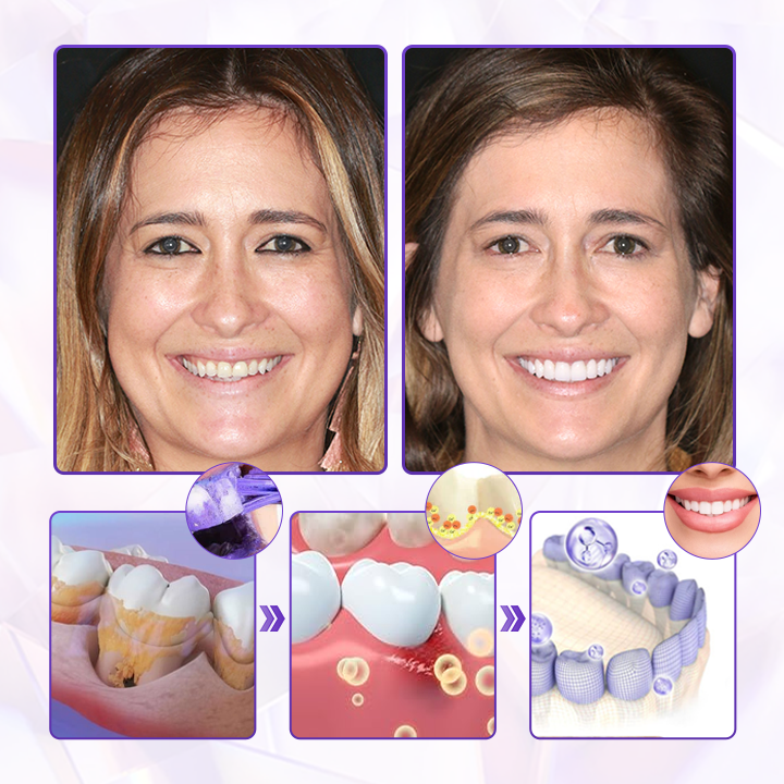 BeeRenew - Restore Gum Vitality Instantly + 50% OFF