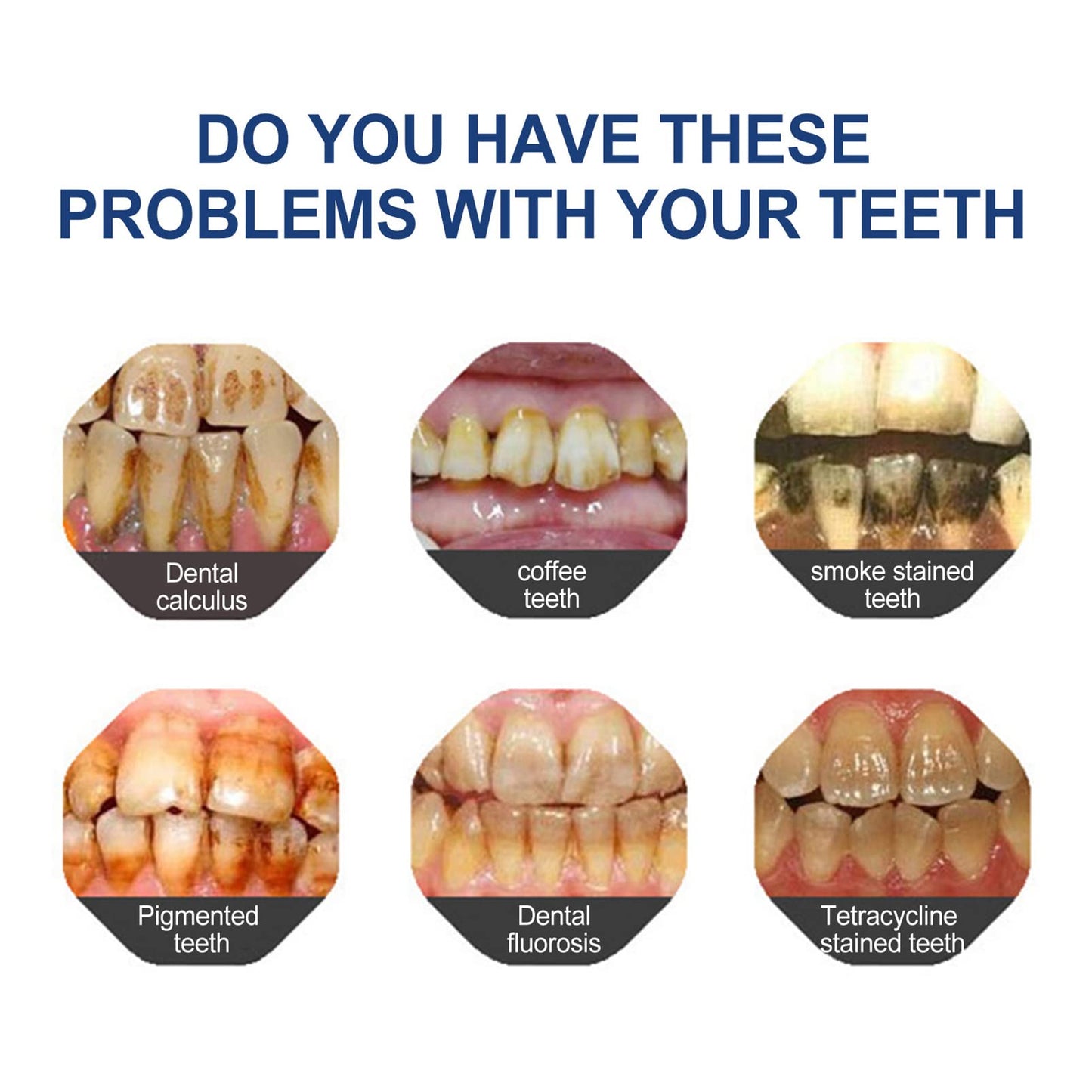 The BioShield Mineral Powder - Rebuild Your Enamel, End Sensitivity + 50% OFF