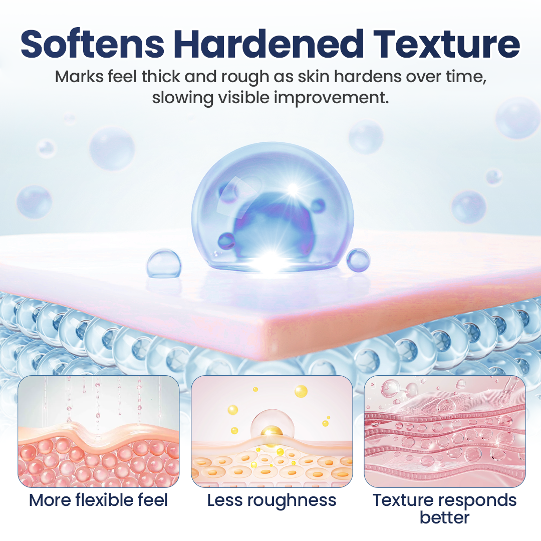 ScarRefine – Erase Scars & Restore Texture + 50% OFF TODAY