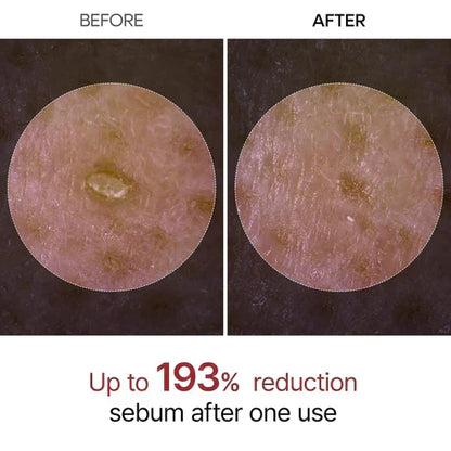 GlowRice™ Gentle Exfoliator Ampoule- 50 % OFF