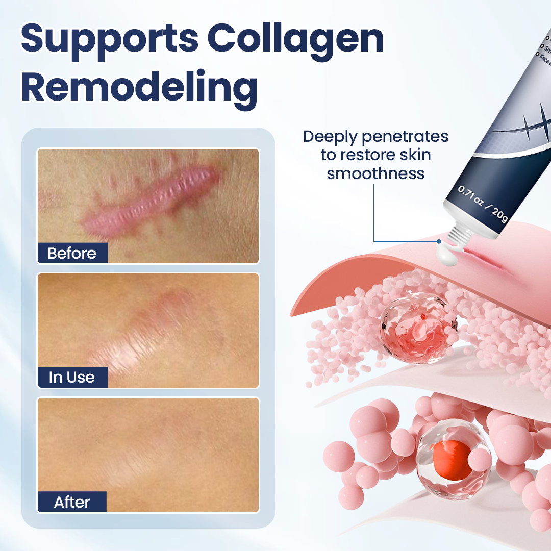 ScarRefine – Erase Scars & Restore Texture + 50% OFF TODAY