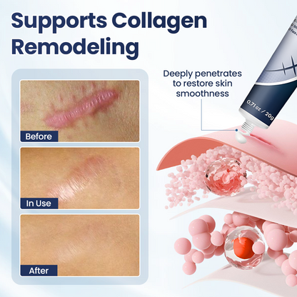 ScarRefine – Erase Scars & Restore Texture + 50% OFF TODAY