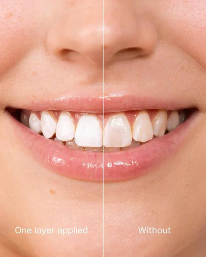 The AuraGlow Tooth Polish — Instant Radiance for a Brighter Smile + 50% OFF