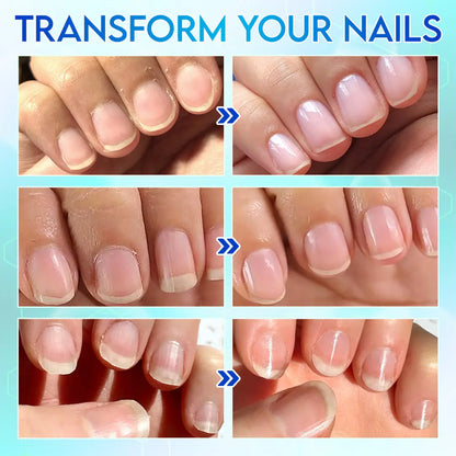 ComfortTrim 360 — Gentle Nail Care Made Easy + 50% OFF