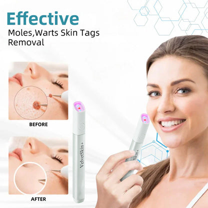 DermaBeam Pro – Erase Skin Flaws Instantly + 50% OFF