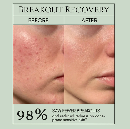 PorePure Bubble Mask - Clear Skin in 7 Days + 50% OFF