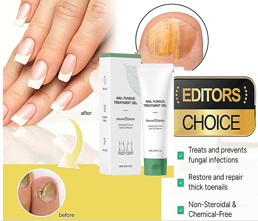 The AuraFungus Anti-Fungal Gel - Podiatrist-Recommended, 100% Organic, and 120-Day Guarantee + 50% OFF