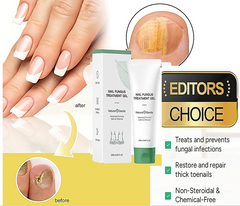 The AuraFungus Anti-Fungal Gel - Podiatrist-Recommended, 100% Organic, and 120-Day Guarantee + 50% OFF