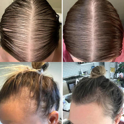 The AuraGrowth Minopia Oil - 11 Oil Concentrated Growth Blend, 100 Vegan, and Thicker Hair in 45 Days + 50% OFF