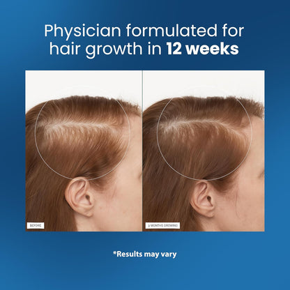 The Triple-Action Hair Serum - Thicker Strands, No Mess + 50% OFF