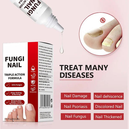 NailRenew™ Triple-Action Nail Repair - Clear Nails, Renewed Confidence + 50% OFF