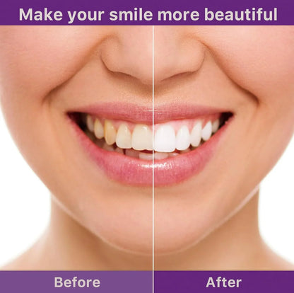 LumiSmile Whitening Teeth Powder- 50 % OFF
